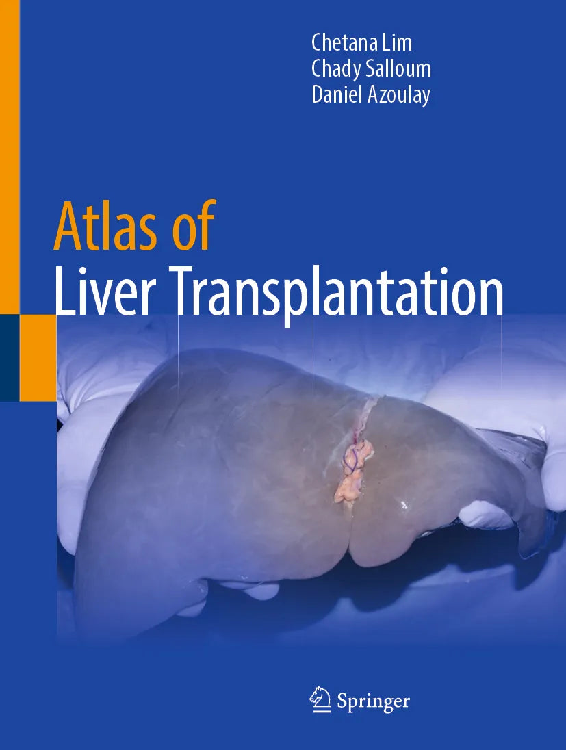 Cover: Atlas of Liver Transplantation (E-Book) von Chetana Lim
