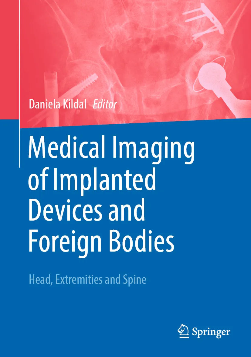 Cover: Medical Imaging of Implanted Devices and Foreign Bodies (E-Book)