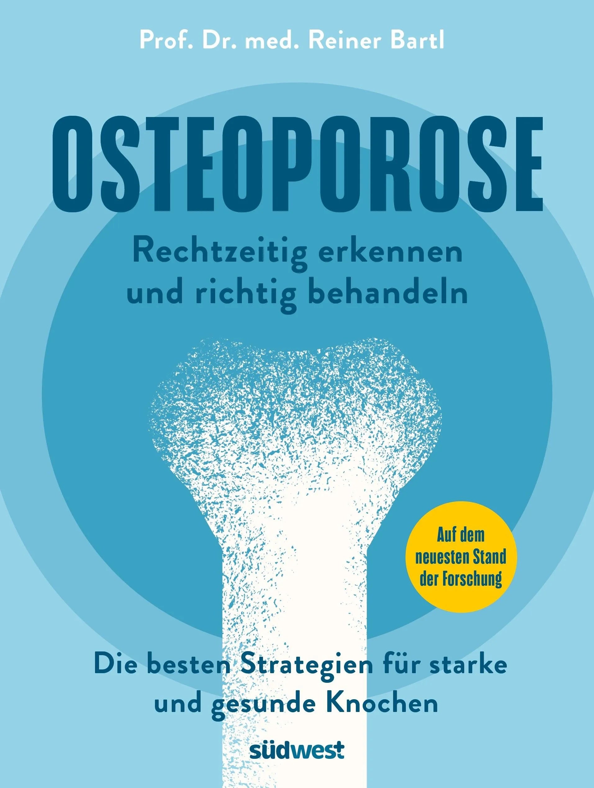 Cover: Osteoporose rechtzeitig erkennen und behandeln (Taschenbuch) von Reiner Bartl