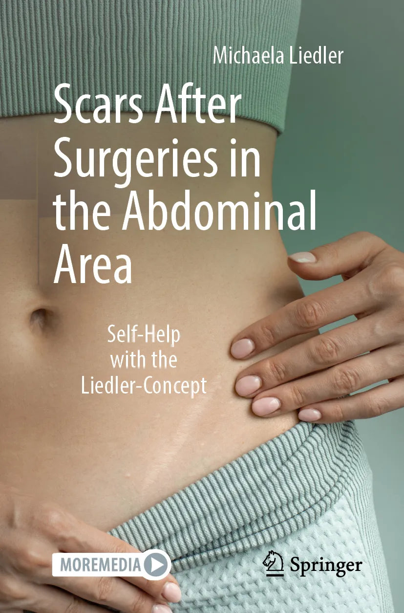 Cover: Scars After Surgeries in the Abdominal Area (E-Book) von Michaela Liedler
