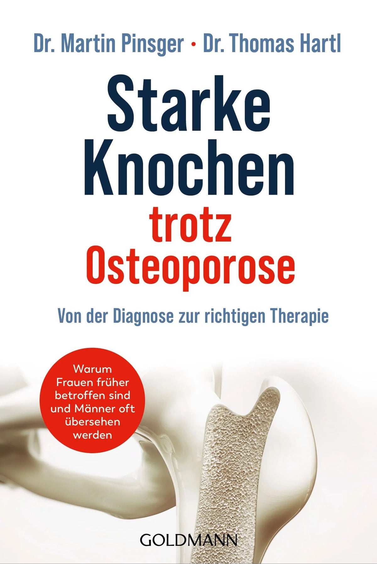 Cover: Starke Knochen trotz Osteoporose (Taschenbuch) von Thomas Hartl