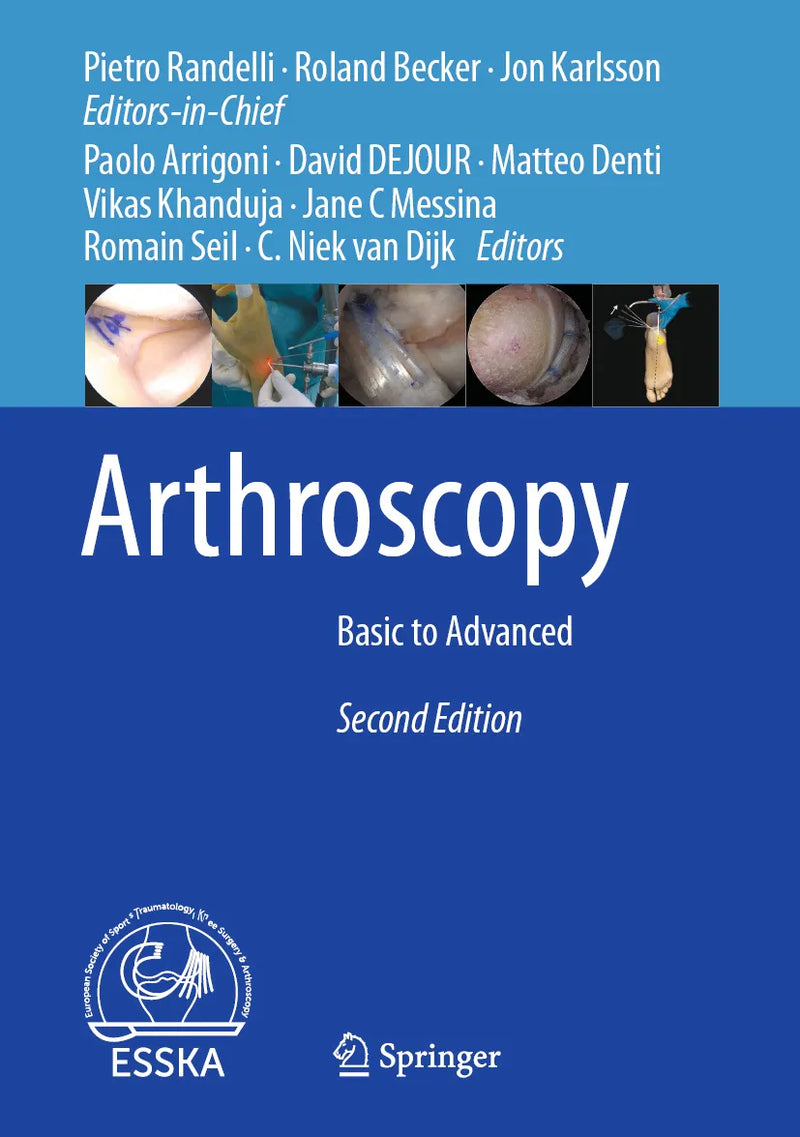Arthroscopy