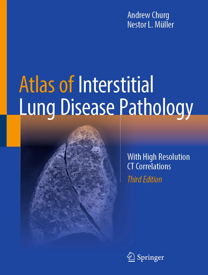 Cover: Atlas of Interstitial Lung Disease Pathology (E-Book) von Andrew Churg