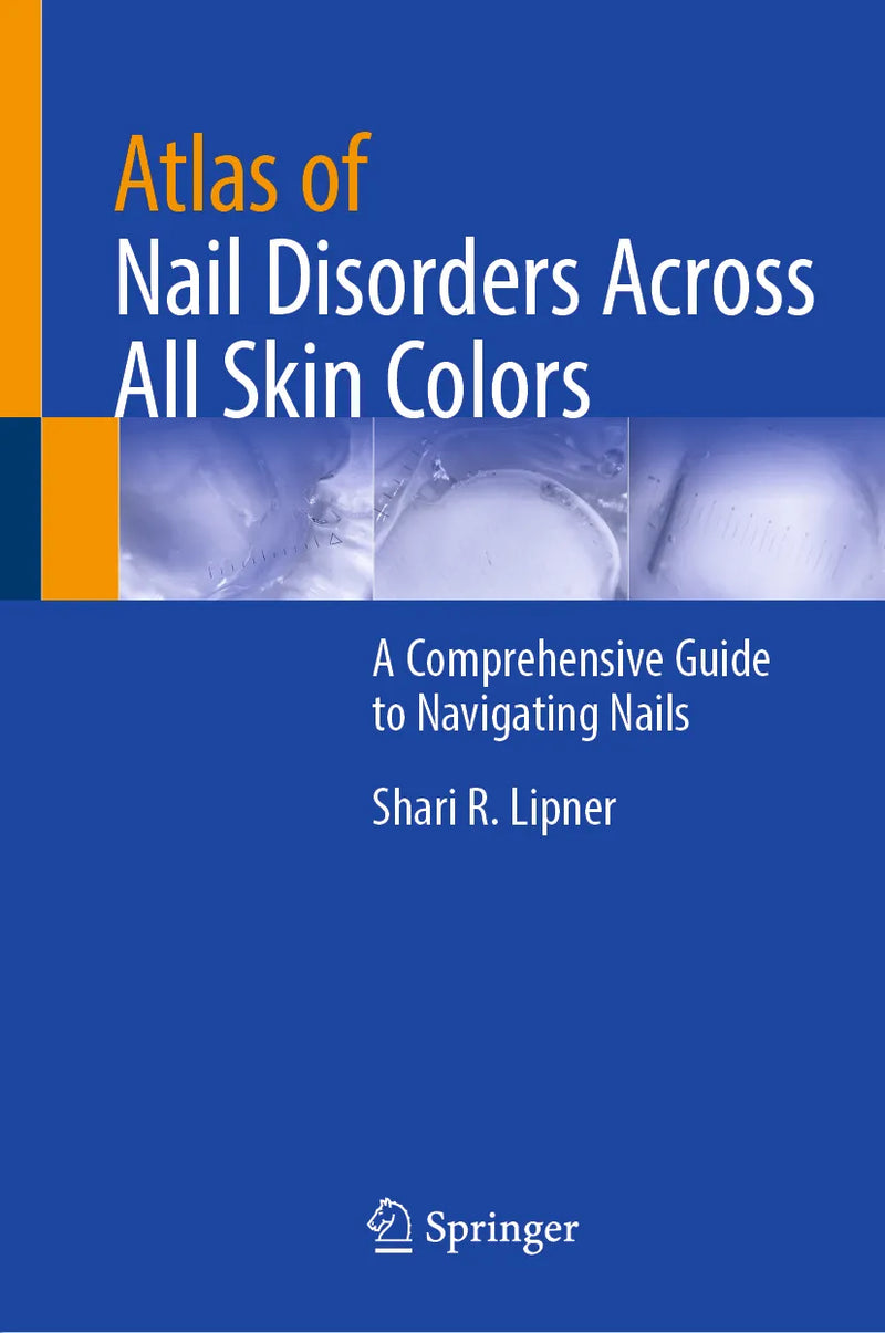 Atlas of Nail Disorders Across All Skin Colors