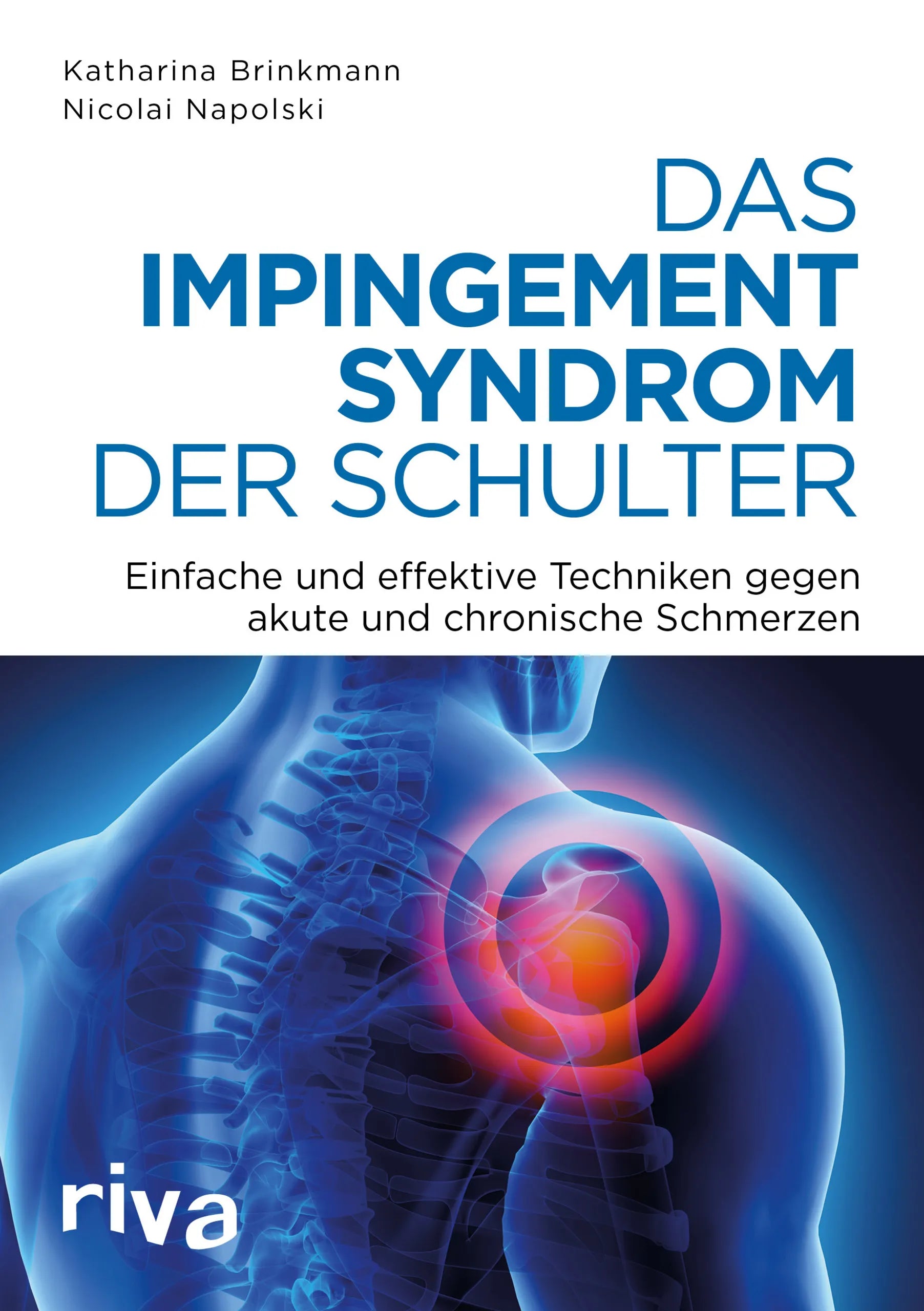 Buchcover von 'Das Impingement-Syndrom der Schulter' - Taschenbuch von Nicolai Napolski