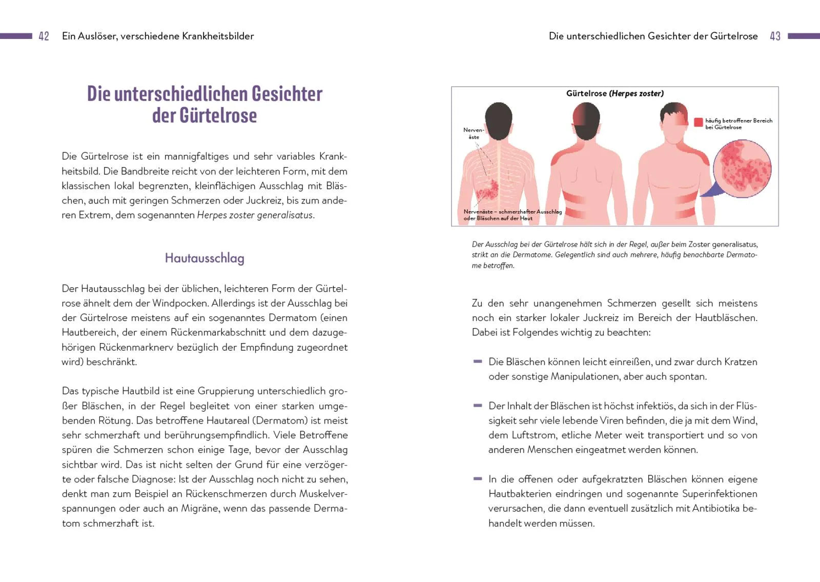 Innenansicht von 'Gürtelrose' - Taschenbuch