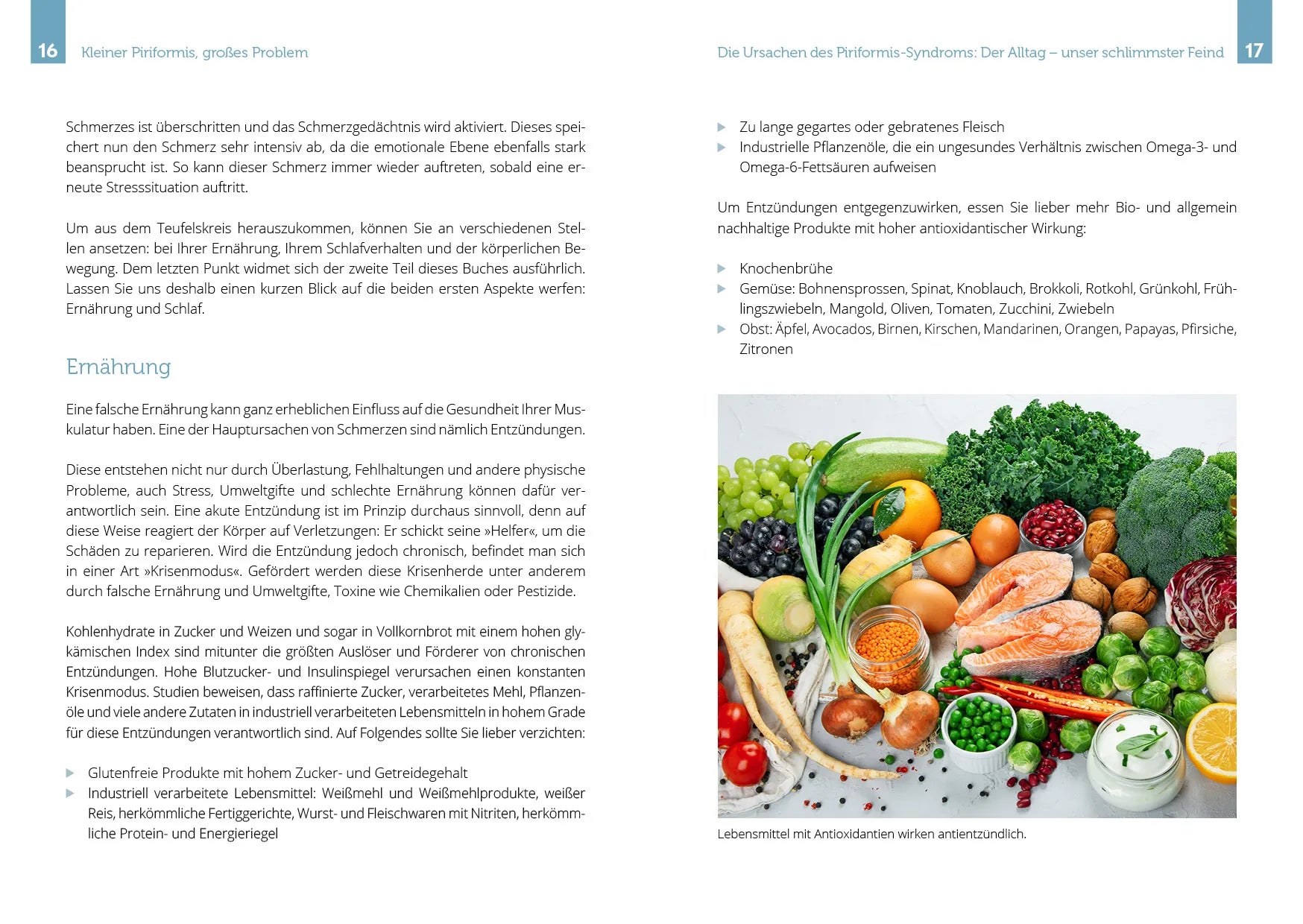 Innenansicht von 'Ischiasbeschwerden und das Piriformis-Syndrom' - Taschenbuch