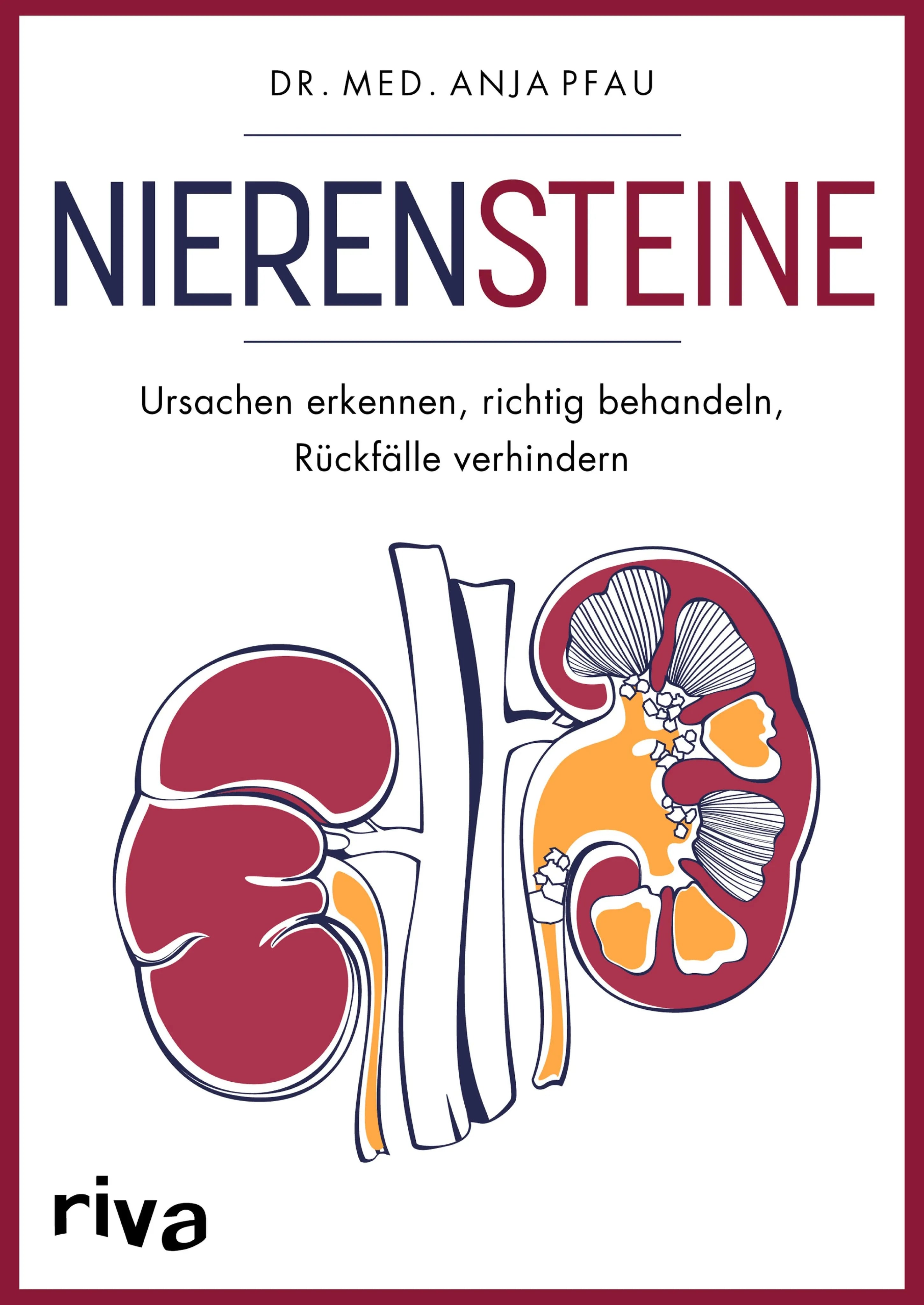 Cover: Nierensteine – Ursachen erkennen, richtig behandeln, Rückfälle verhindern (E-Book) von Anja Pfau
