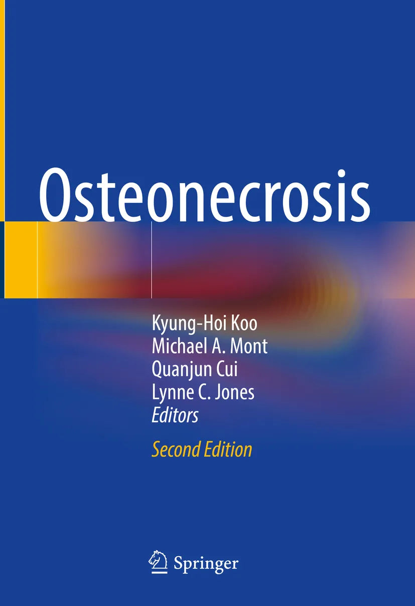 Cover: Osteonecrosis (E-Book)