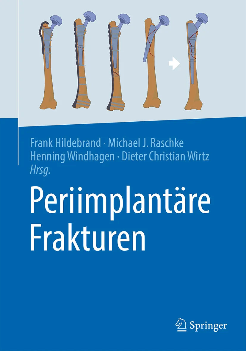 Cover: Periimplantäre Frakturen (E-Book)