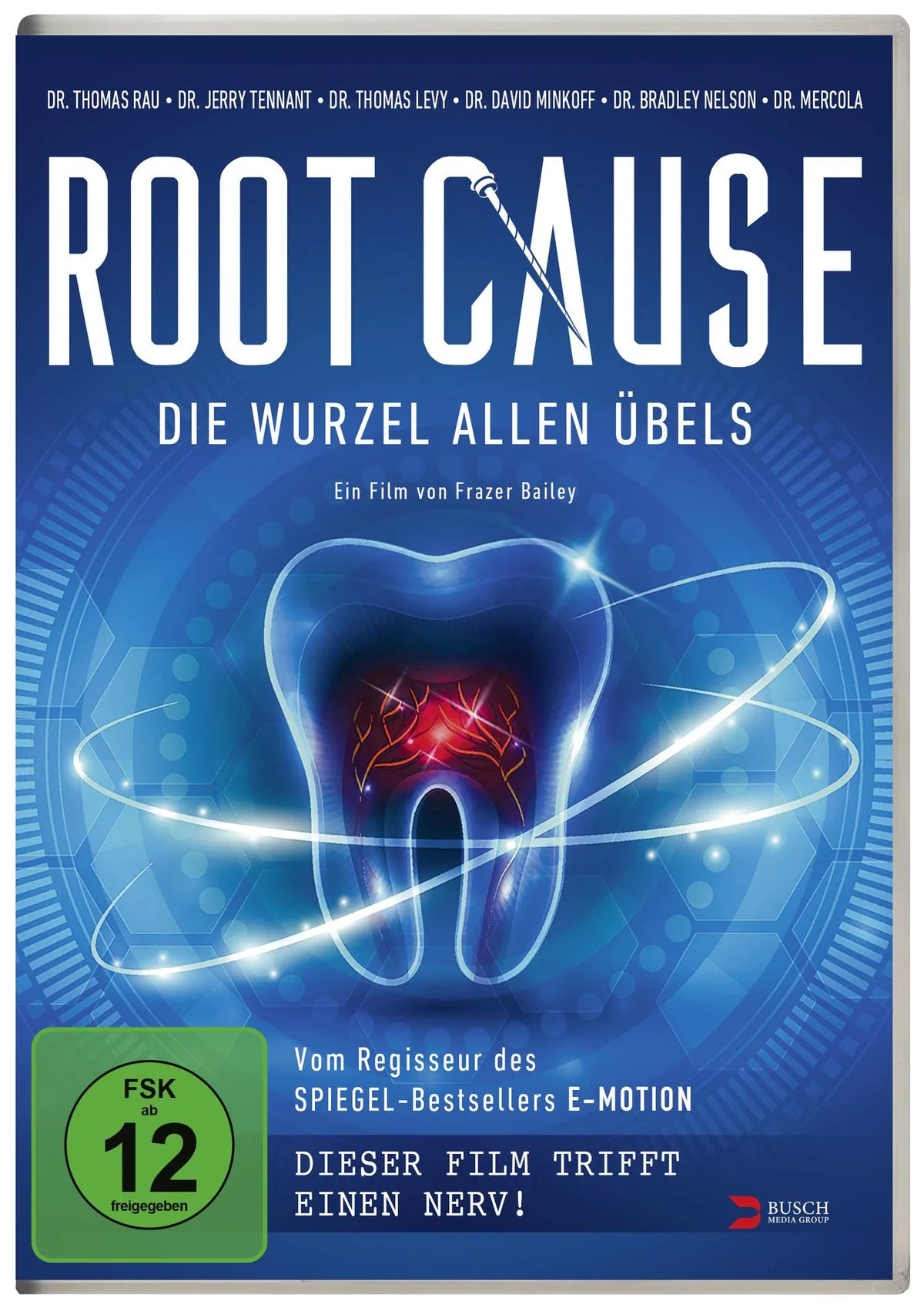 Root Cause - DVD