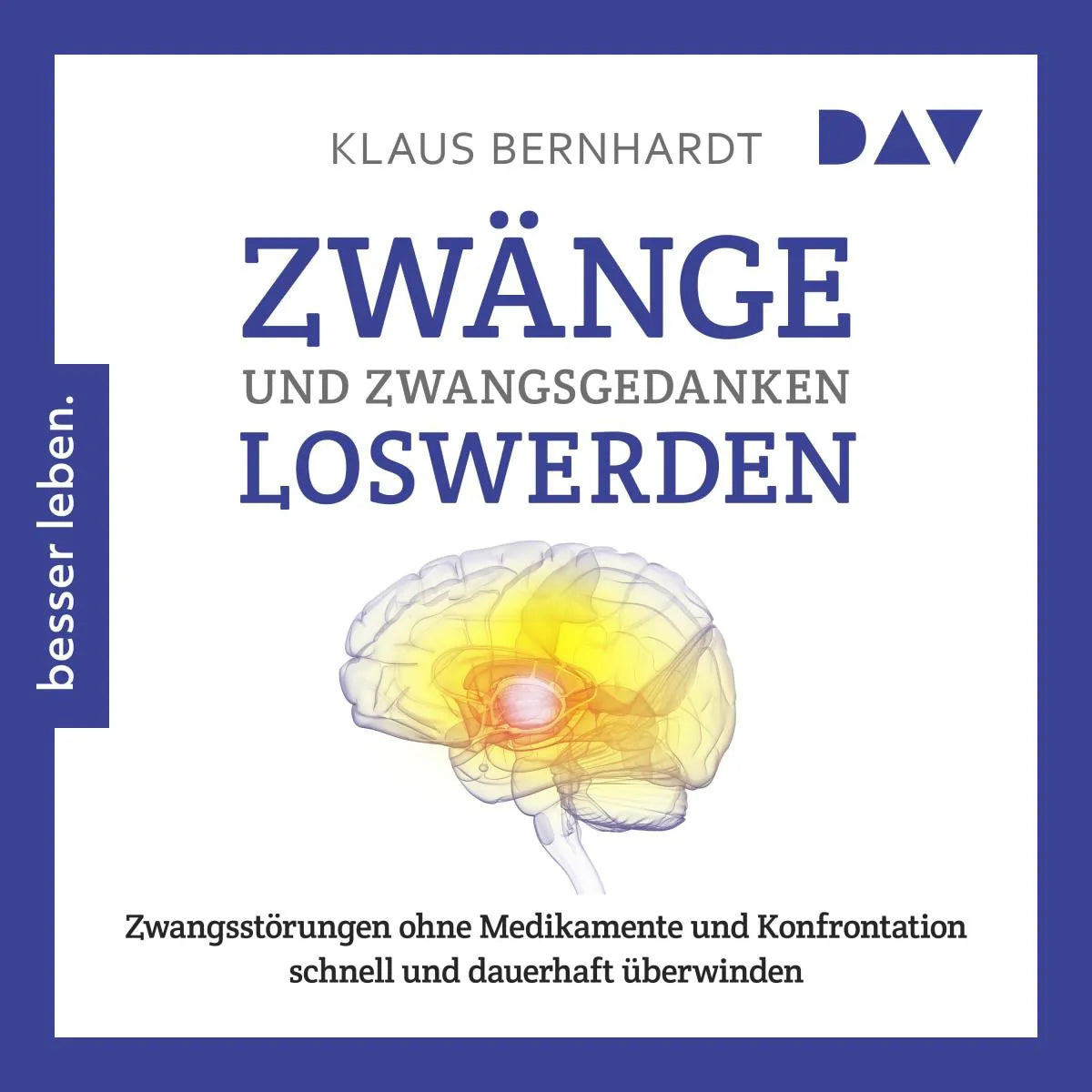 Cover: Zwänge und Zwangsgedanken loswerden. Zwangsstörungen ohne Medikamente und Konfrontation schnell und dauerhaft überwinden (Hörbuch Download) von Klaus Bernhardt